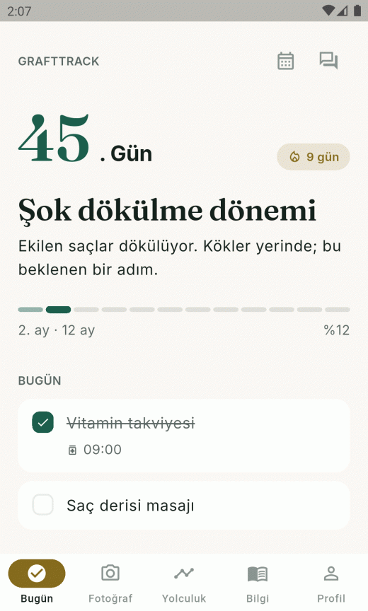 Şok dökülme dönemi ekranı: 45. gün, sıcak kum tonlu zemin, azaltılmış görev listesi