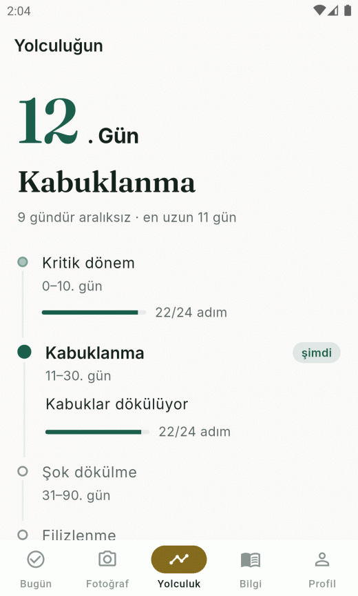 GraftTrack yolculuk haritası: kritik dönem, kabuklanma, şok dökülme ve filizlenme fazları gün aralıklarıyla
